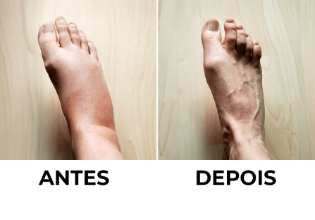 Imagem ilustrativa para o terceiro passo da rotina Babosa Mil
